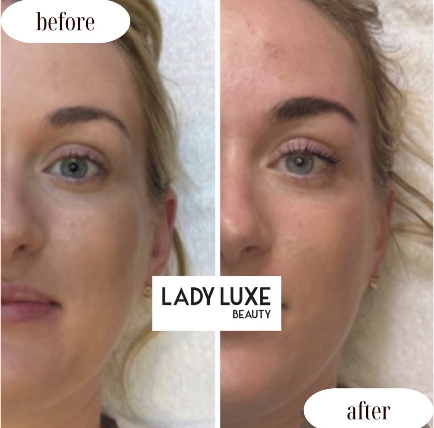 Dull Skin before and after